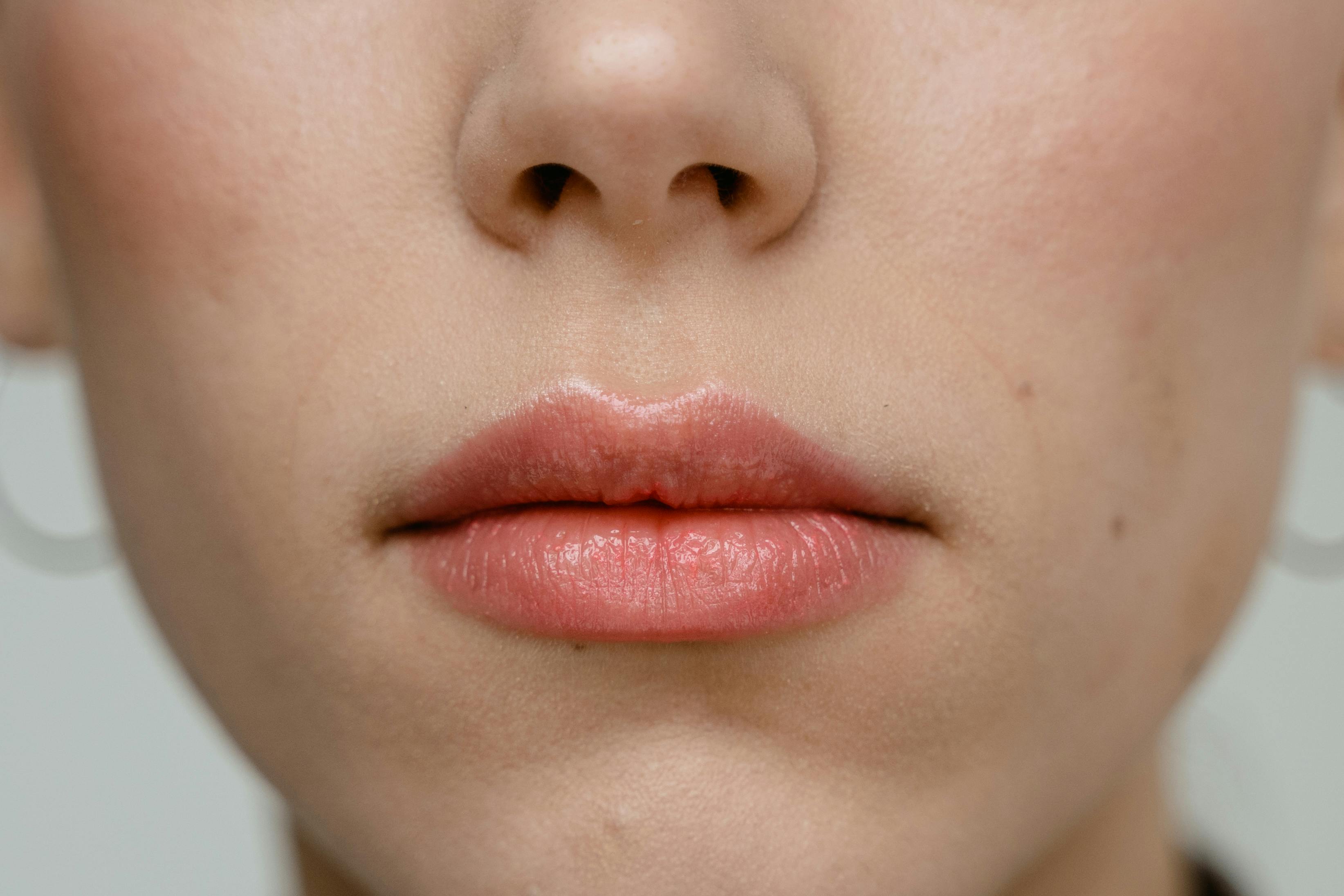 5 Reasons Why Natural Lip Care is the Best Care